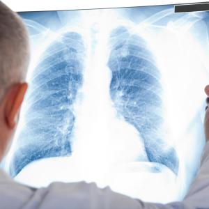 Tezepelumab improves lung function in severe asthma