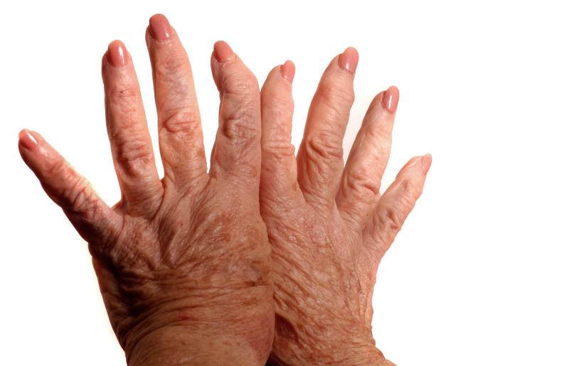 Index-to-ring finger ratio may identify older adults prone to TMCJ osteoarthritis