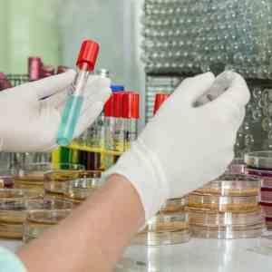 Testosterone deficiency a concern in Asia