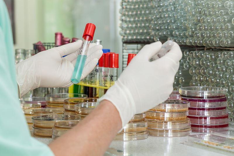 Testosterone deficiency a concern in Asia
