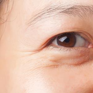 Novel collagen delivery shows promise for wrinkle reduction