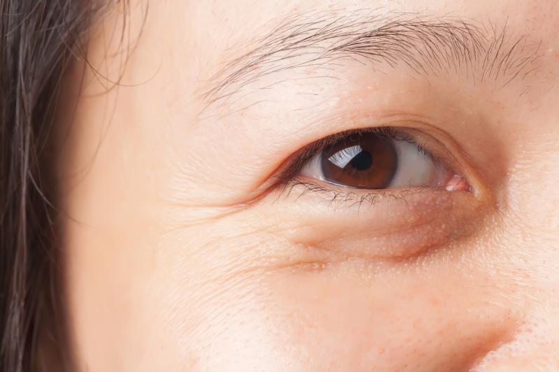 Novel collagen delivery shows promise for wrinkle reduction