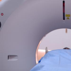 CT scan radiation poses blood cancer risk in young people