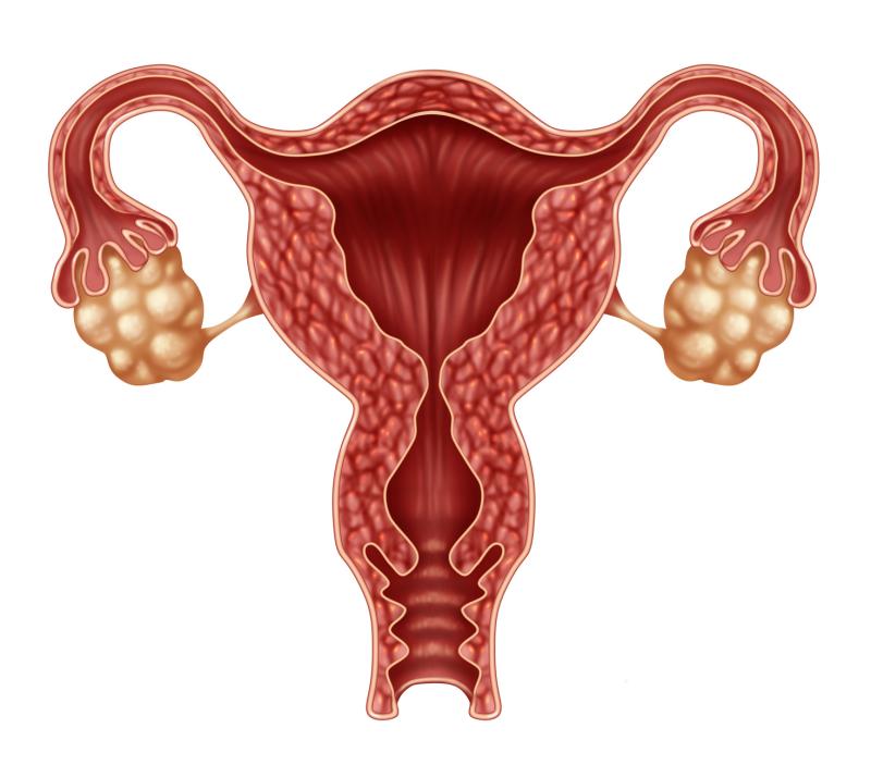 Immunosuppression treatment with mTORi carries risk of ovarian cyst