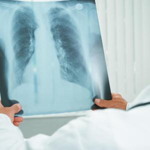 Which factors set off TB recurrence?