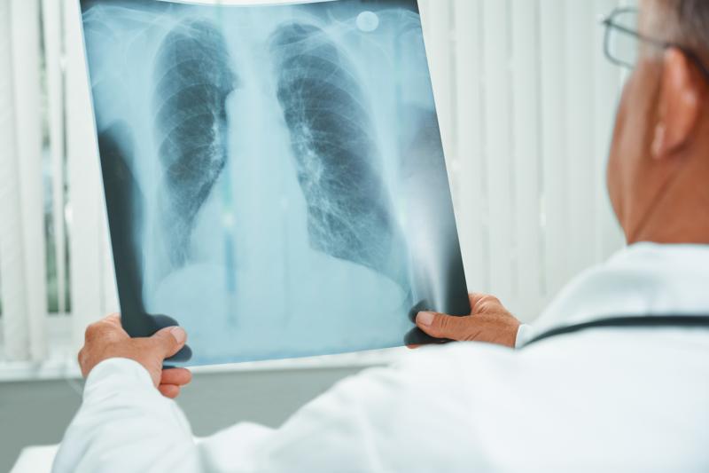 Which factors set off TB recurrence?