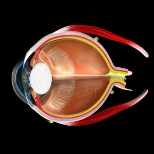 Repeat examination may be prudent after acute posterior vitreous detachment