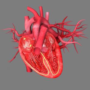 High BMI, lipoprotein(a) levels up risk of calcific aortic valve disease