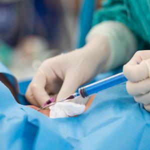 General anaesthesia, epidural analgesia may improve postsurgical outcomes for paediatric tumours