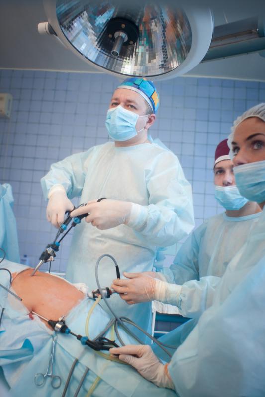 Robotic cystectomy safer than open cystectomy