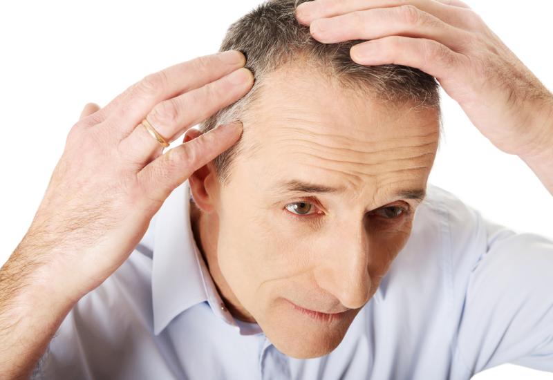 COVID-19 may trigger hair, nail disorders