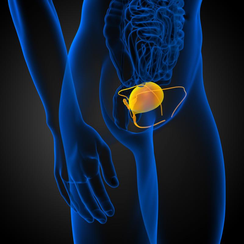 Ureteral wall thickness predicts stone impaction, outcomes