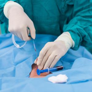 Electrocautery-enhanced LAMS boasts shorter procedure in PCS management