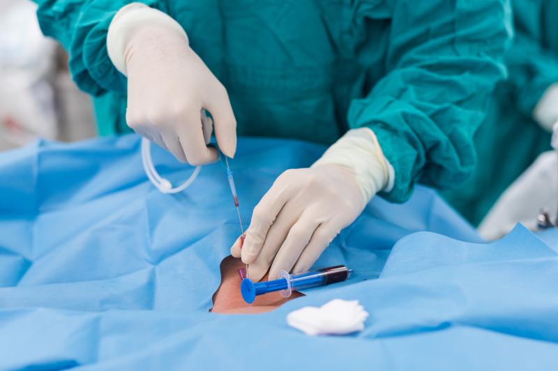 Electrocautery-enhanced LAMS boasts shorter procedure in PCS management