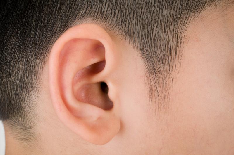 Transcutaneous bone conduction implants lead to better hearing in microtia