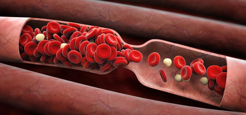 High serum phosphorus ups risk of coronary atherosclerosis in asymptomatic individuals