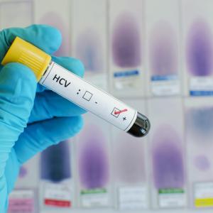 Point-of-care HCV screening with direct access improves linkage of care in people with substance misuse