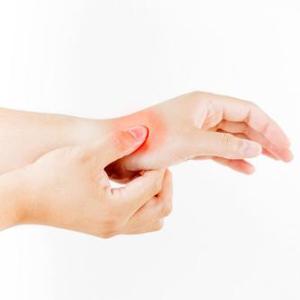 Patients on anticancer therapeutic agents may develop carpal tunnel syndrome