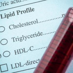 Diabetes status modifies associations of diet quality with serum lipoproteins