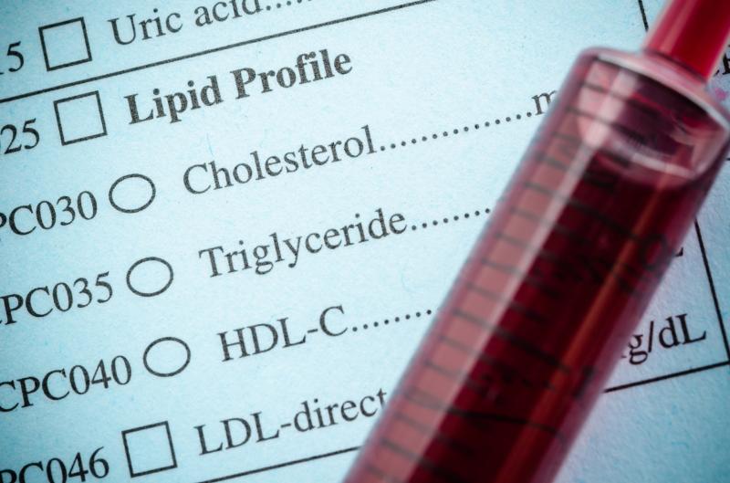 Diabetes status modifies associations of diet quality with serum lipoproteins