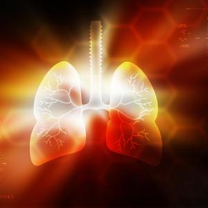 Osteopontin gene expression tied to disease severity in pulmonary arterial hypertension