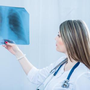 Bedaquiline, delamanid both effective against multidrug-resistant tuberculosis