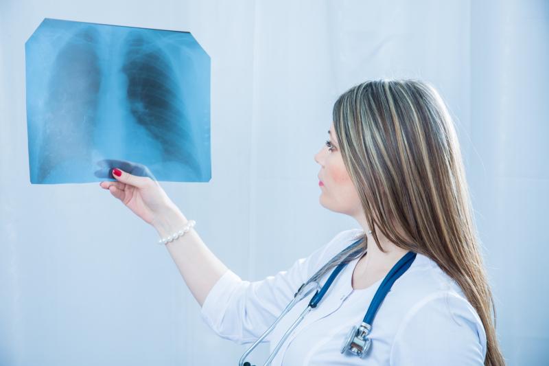 Bedaquiline, delamanid both effective against multidrug-resistant tuberculosis