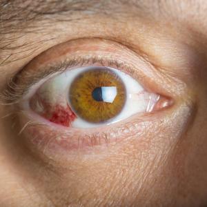 Nutritional risk in older diabetes patients tied to diabetic retinopathy