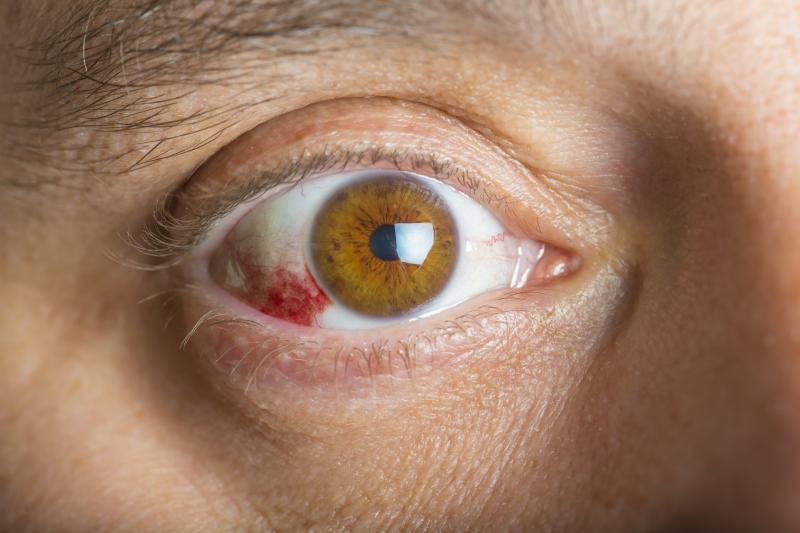 Nutritional risk in older diabetes patients tied to diabetic retinopathy