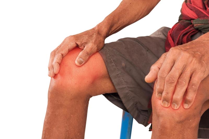 People with psoriatic arthritis at greater risk of developing osteoarthritis