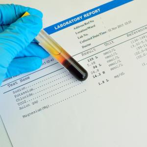 Nonoptimal serum calcium levels worsen mortality in heart attacks