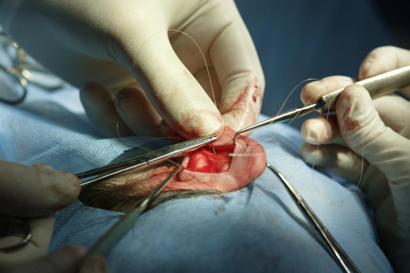 Fibrin glue matches suture repair for peripheral nerve repair