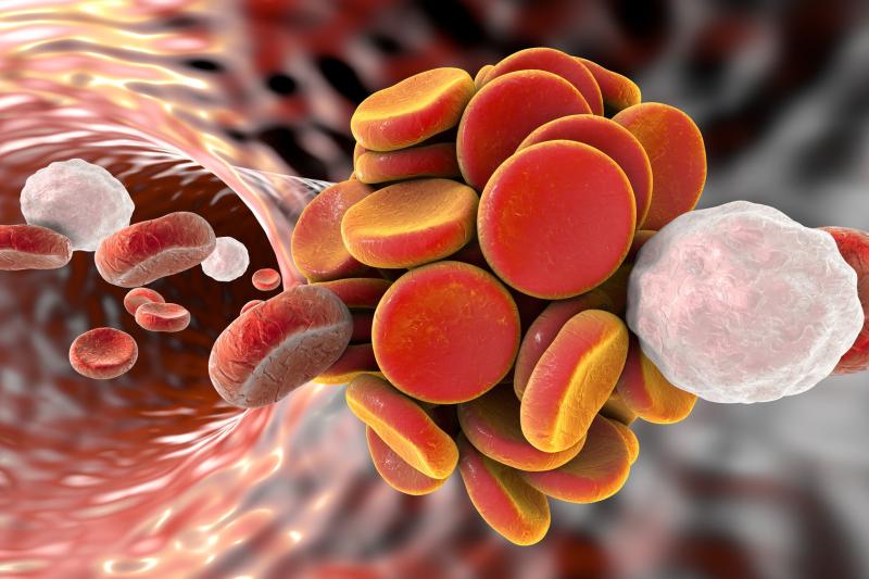 Adults with nephrotic syndrome at greater risk of thromboembolism, bleeding