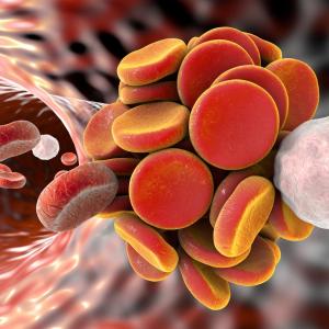 Edoxaban prevents thromboembolism in children with cardiac disease