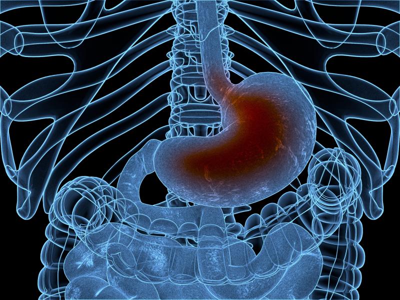 Per-oral endoscopic myotomy safe, effective in spastic oesophageal motility disorders