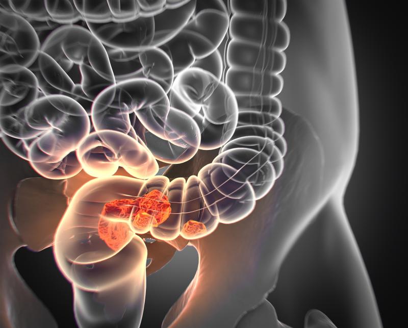 Tumour response-speed heterogeneity linked to poor survival in metastatic colorectal cancer