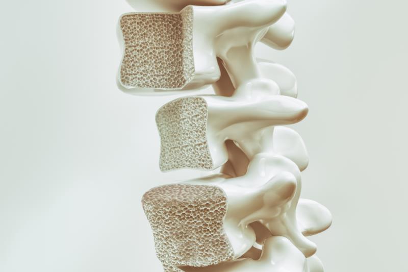 Denosumab an option for high-risk glucocorticoid-induced osteoporosis