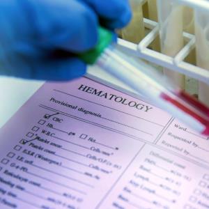 Coagulation test may predict COVID-19 severity, mortality