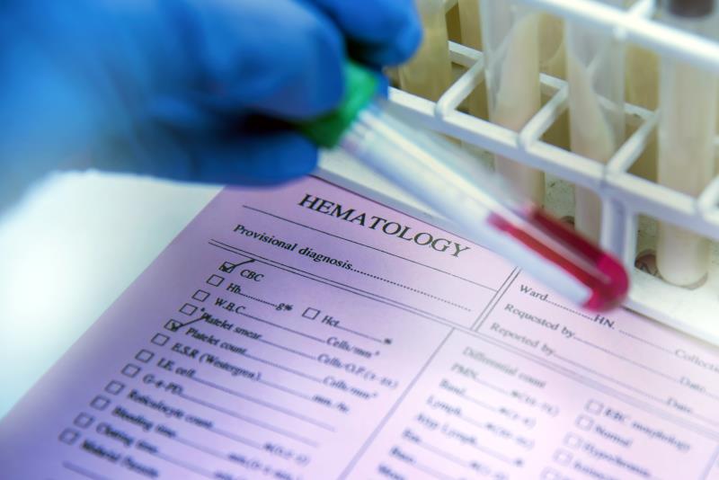 Haematological, coagulation parameters may predict COVID-19 severity, mortality