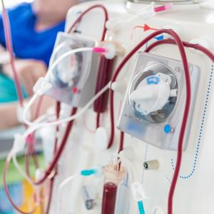 New questionnaire accurately measures light exercise among dialysis patients