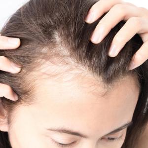 High hair cortisol foreshadows acute myocardial infarction