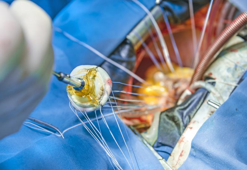 In intermediate risk patients, the TAVR is found to have better outcomes