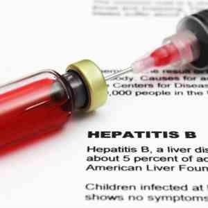 Revealed: Hepatitis B viral load critical to infection clearance