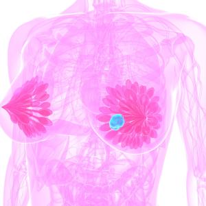 Omeprazole helps inhibit fatty acid synthase activity in triple-negative breast cancer