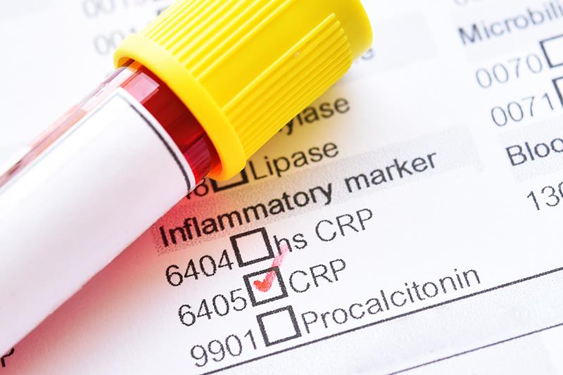 Increased levels of serum C-reactive protein (CRP) may contribute to shorter survival in patients with <a href="https://www.m