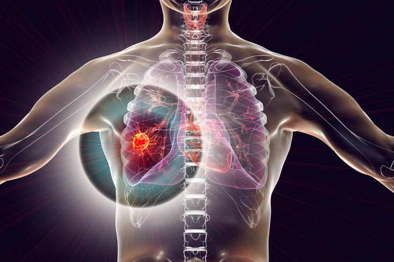 Which first-line treatment provides the best survival for patients with EGFR-mutated NSCLC?