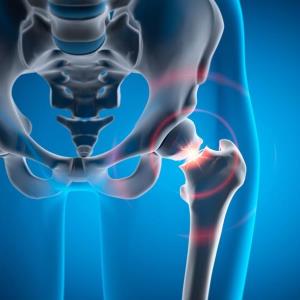 OSHK Guideline updates for pharmacological management of postmenopausal osteoporosis