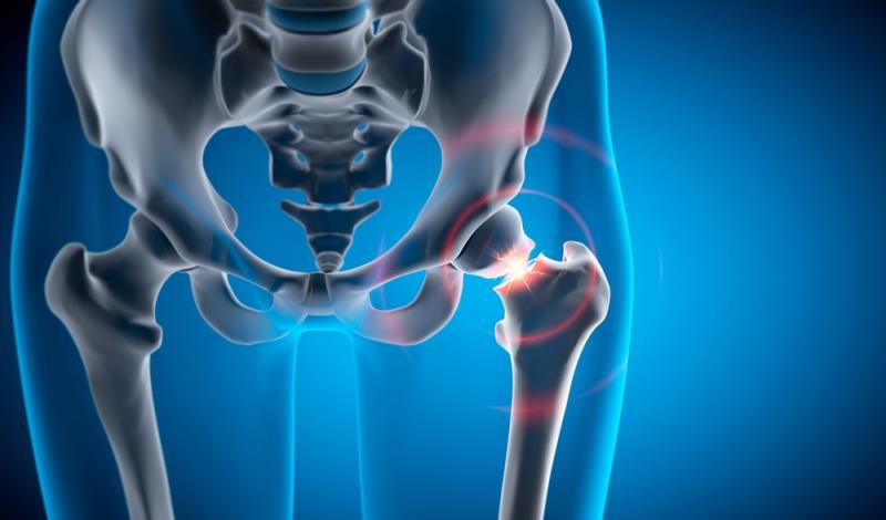 OSHK Guideline updates for pharmacological management of postmenopausal osteoporosis