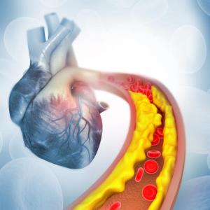 Use of a PCSK9 inhibitor in a patient with established ASCVD