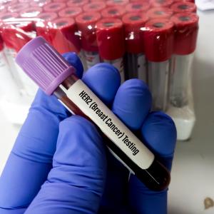 Second-line antibody-drug conjugate in a patient with HR-positive, HER2-low advanced breast cancer